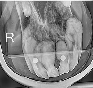 Severe Eotrh Scan