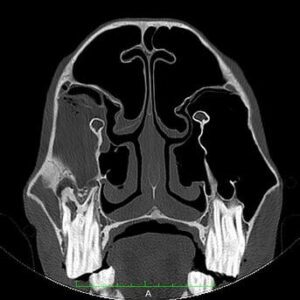 Sinus Scan