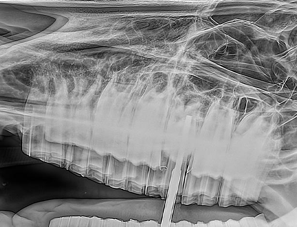 Minimally Invasive Transbuccal Extraction